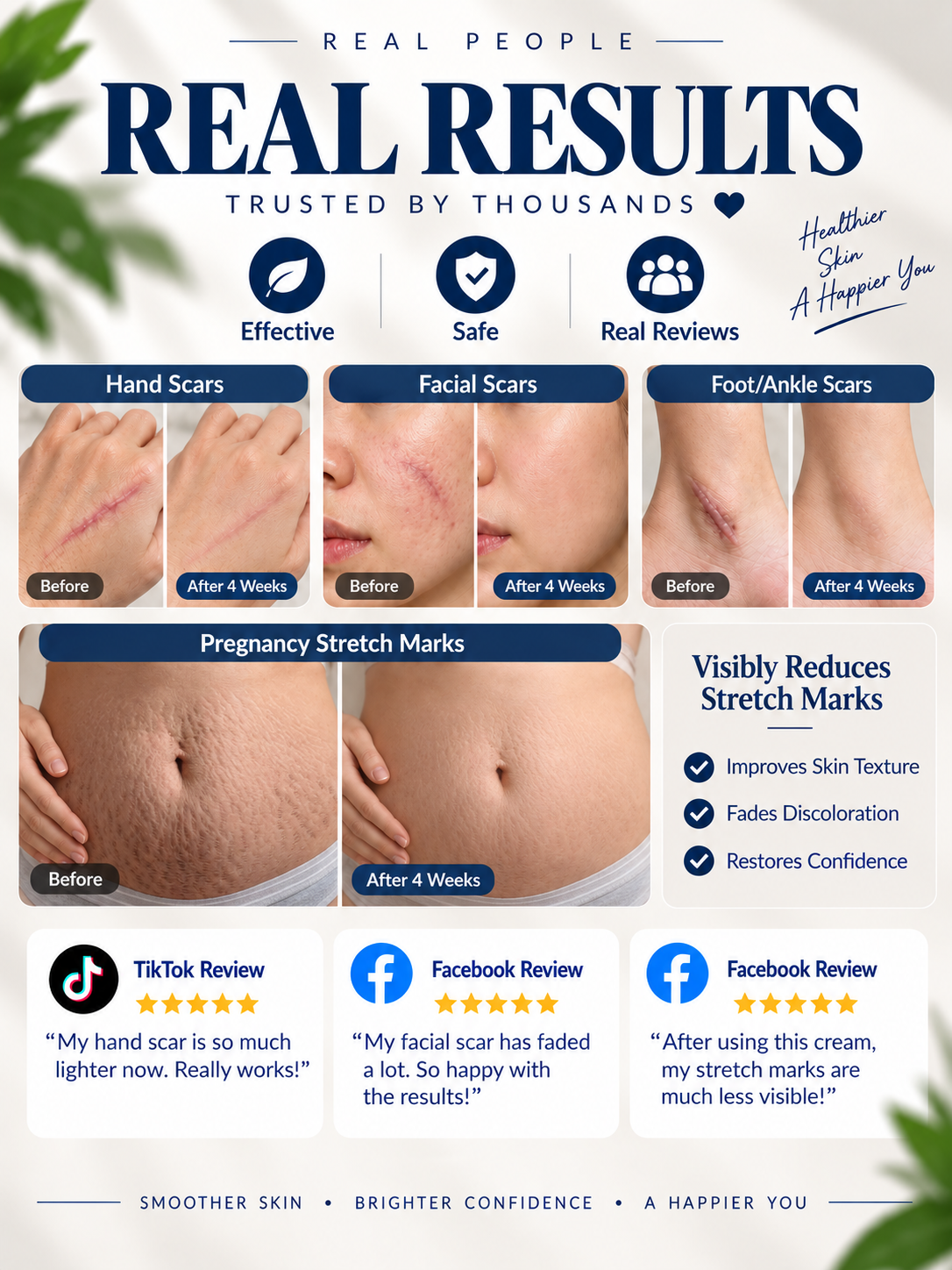 🍃Scar Repair Cream – Smooth & Fade Visible Scars-918